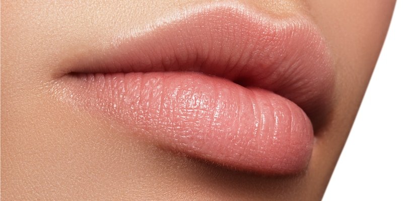 Op deze foto worden lippen afgebeeld die met lip fillers hyaluronzuur zijn behandeld.