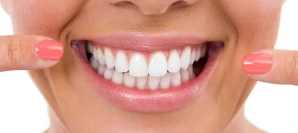 Dit is een foto van een vrouw met prachtige witte tanden en glimlach.