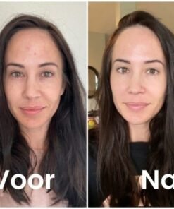 Deze vrouw behandeld haar gezicht met vitamine c serum 30ml. De foto geeft het resultaat van voor en na de behandeling.