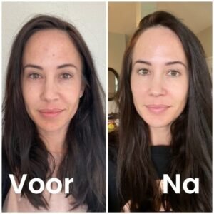 Deze vrouw behandeld haar gezicht met vitamine c serum 30ml. De foto geeft het resultaat van voor en na de behandeling.