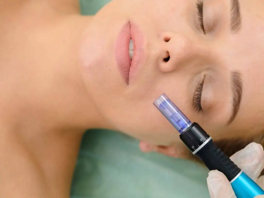 Mesotherapie - Mesogun - Huidverjonging