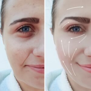 huid serum resultaat voor en na