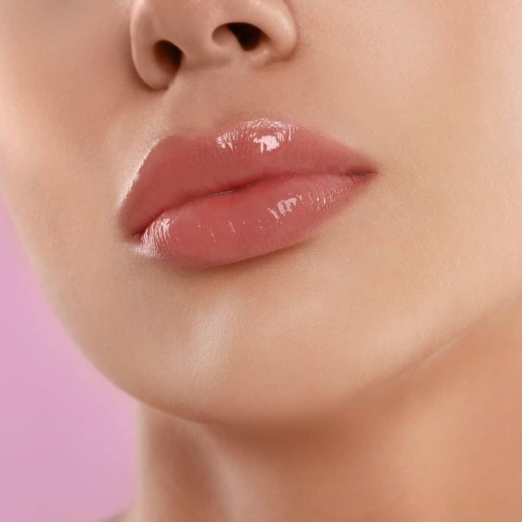 hyaluronzuur fillers volle lippen lip vullers natuurlijk resultaat