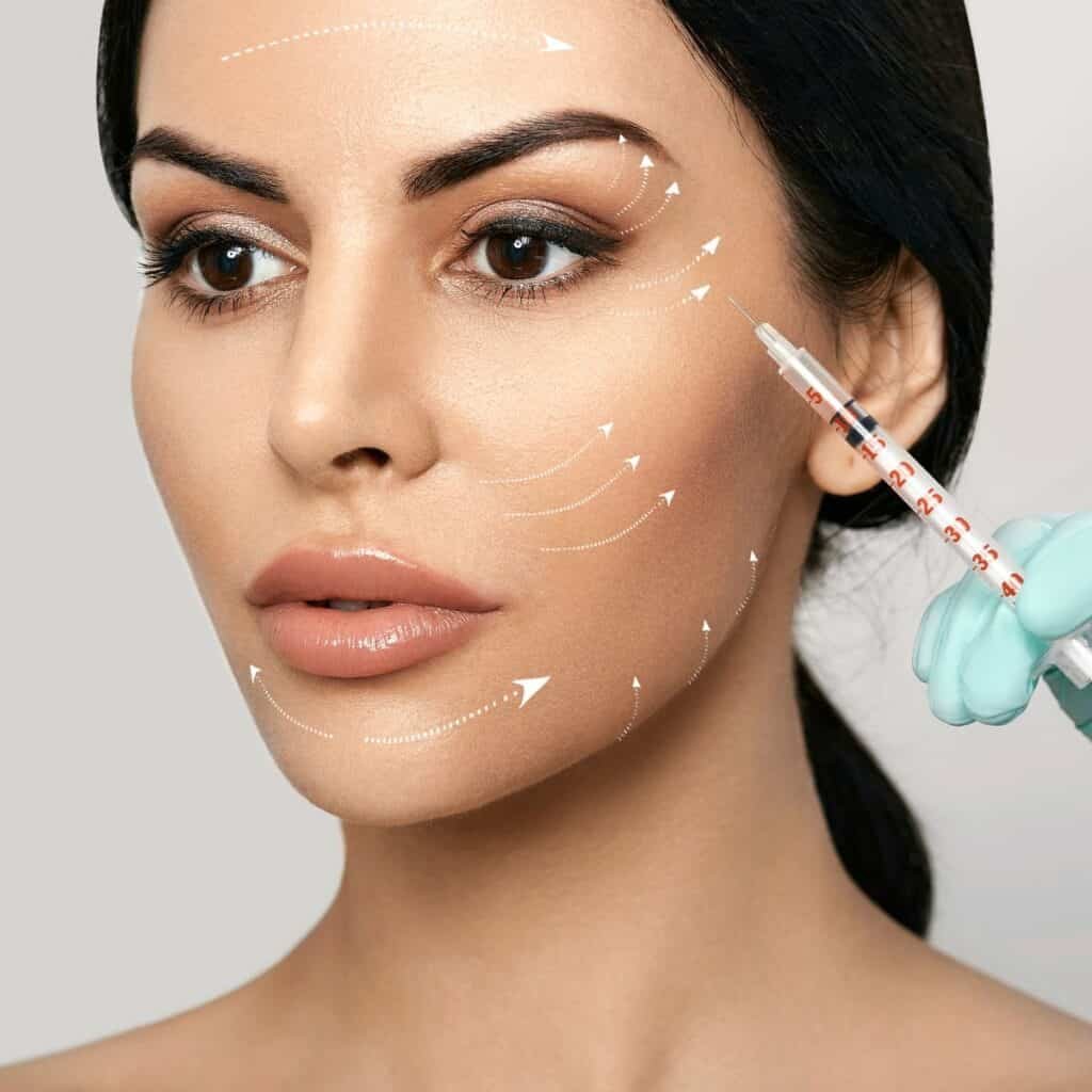 filler gezicht 2 ml hyaluronzuur fillers hyaluronic fillers