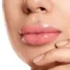 hyaluronzuur fillers vollere lippen mooie lippen natuurlijk resultaat