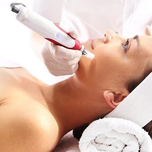 microneedling pen, derma pen, microneedling behandeling, dermapen, anti-aging, huidproblemen