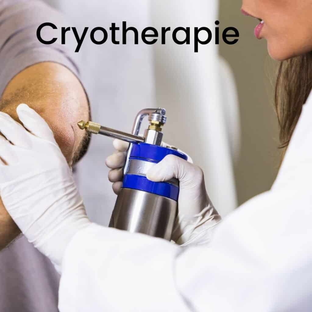 wrat cryotherapie