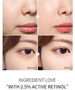 retinol creme met carnosine, hyaluronzuur, vitamine e, gezicht van een vrouw, voor en na behandeling foto `s