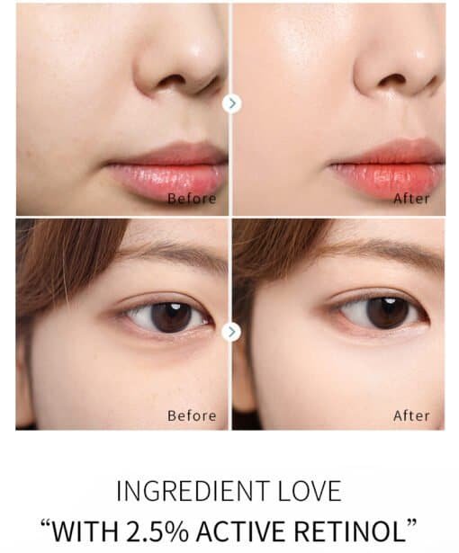 retinol creme met carnosine, hyaluronzuur, vitamine e, gezicht van een vrouw, voor en na behandeling foto `s