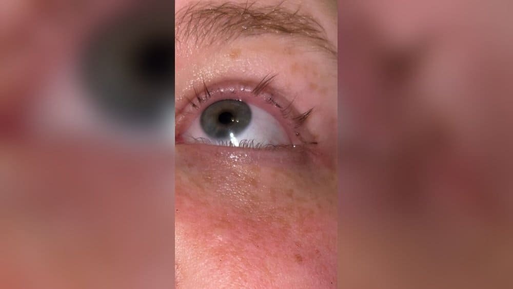 Stoppen Met Wimperserum: Blijven Je Resultaten of Vallen Je Wimpers Terug?