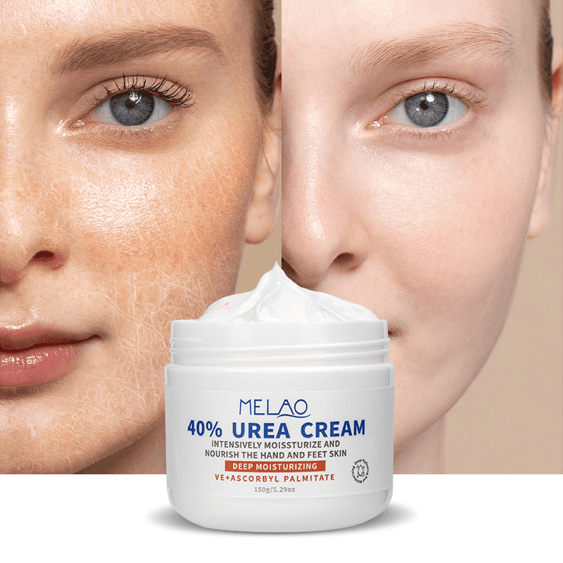 urea crème 40% in pot, voor en na foto